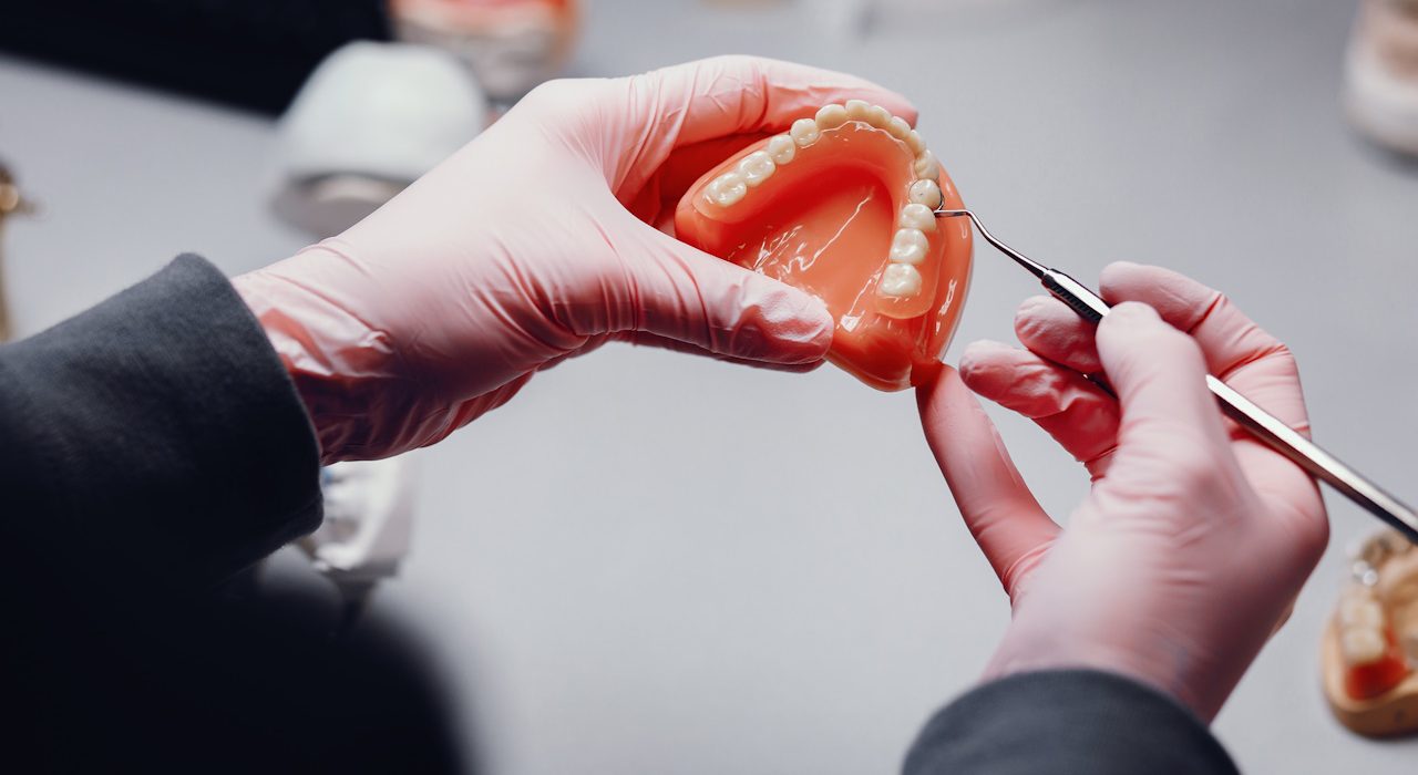 Jakie są różnice między protezami zębowymi a implantami?